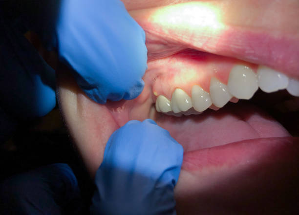 Best Broken or Chipped Tooth Repair in Manhattan, MT